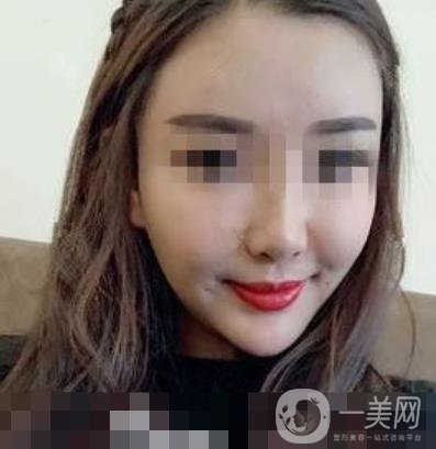 西南醫(yī)院*多少錢?附整形價(jià)格表及真實(shí)案例