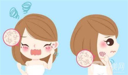 天津等離子除皺價格一般要多少