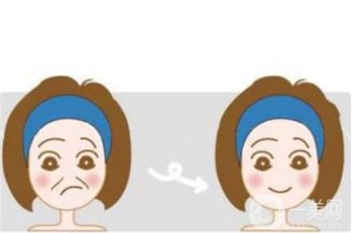 天津等離子除皺價格一般要多少