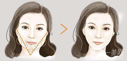 天津做改臉型術(shù)要多少錢