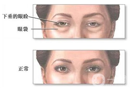 天津公安醫(yī)院整形價格表2020年，內(nèi)附做眼袋*圖