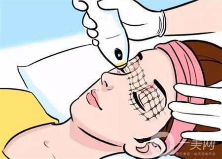 眼部熱瑪吉副作用有哪些呢 如何應對呢？