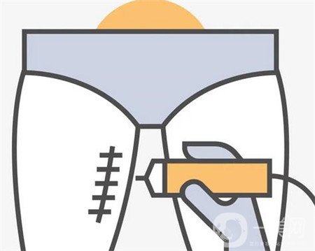 廣東,腰部吸脂,多少錢