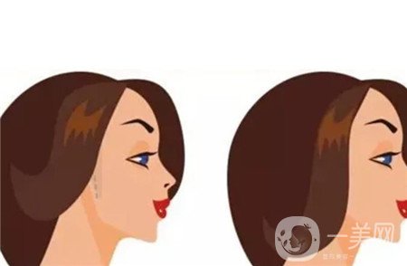 削骨瘦臉價格,削骨瘦臉*果