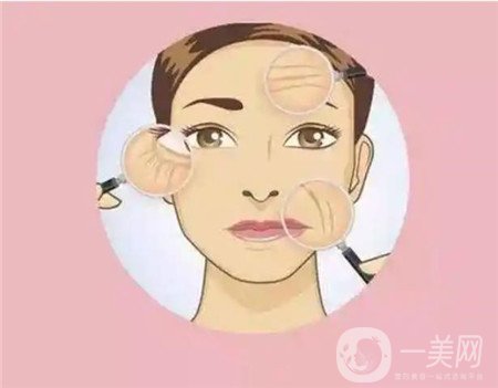 熱瑪吉拉皮除皺多少錢？