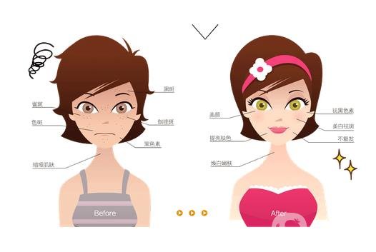 手術(shù)祛痣價(jià)格