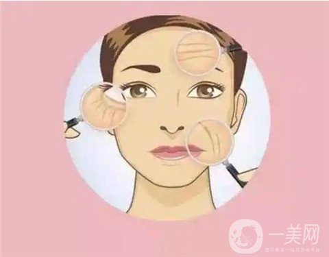 微創(chuàng),面部提升,價(jià)格