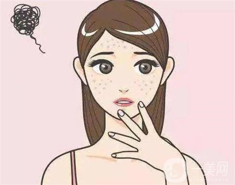 去老年斑的方法都有哪些呢 哪種比較好？