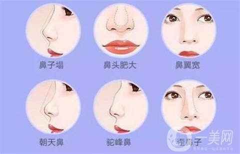 徐州二院整形美容科價(jià)格表，附隆鼻整形案例