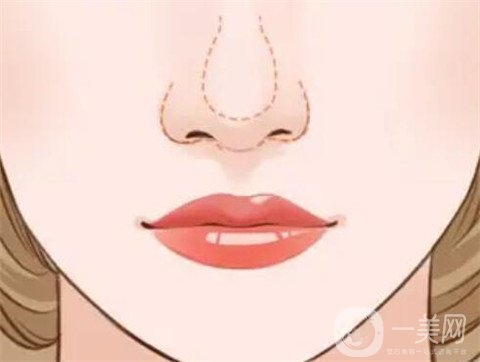 徐州二院整形美容科價(jià)格表，附隆鼻整形案例