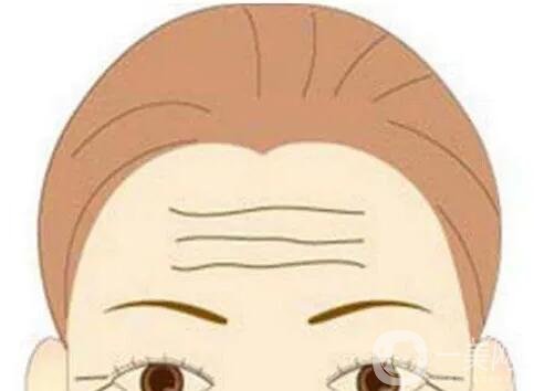 北京面部提升介紹？