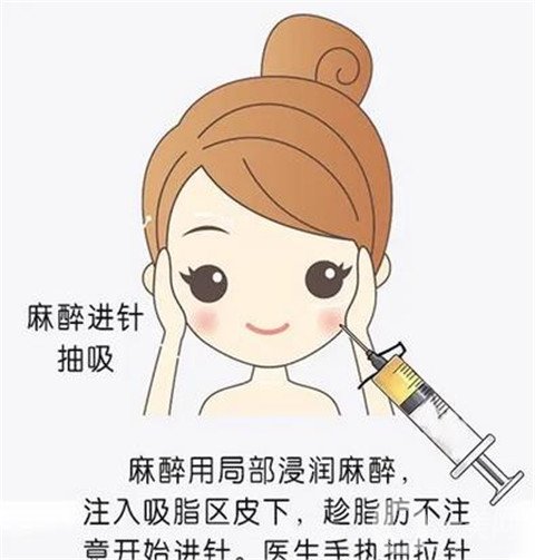 光纖溶脂價(jià)格,上海九院做光纖溶脂貴嗎