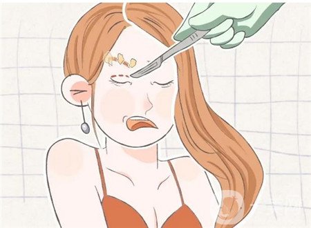 上海韓式開(kāi)內(nèi)眼角多少錢(qián)