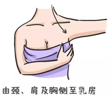 妙桃琴面假體隆胸案例