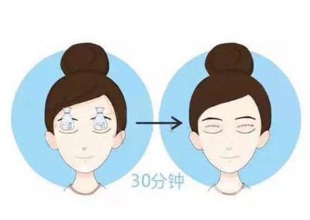 邯鄲三院雙眼皮做得好嗎？整形價(jià)格表及案例分享