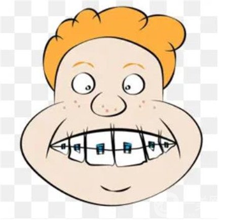 貴陽口腔醫(yī)院整牙貴嗎?正畸價(jià)格表及案例一覽