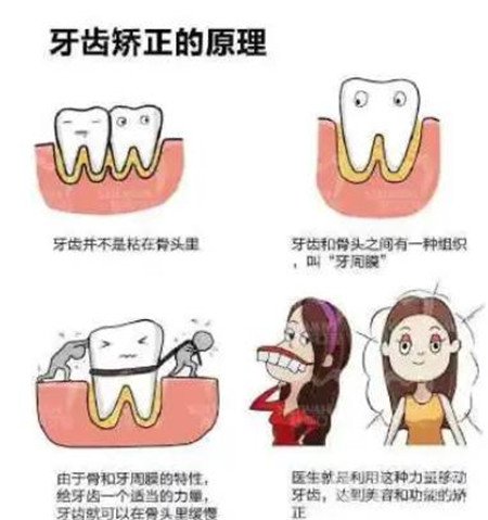 貴陽口腔醫(yī)院整牙貴嗎?正畸價(jià)格表及案例一覽