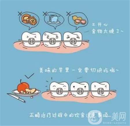 貴陽口腔醫(yī)院整牙貴嗎?正畸價(jià)格表及案例一覽