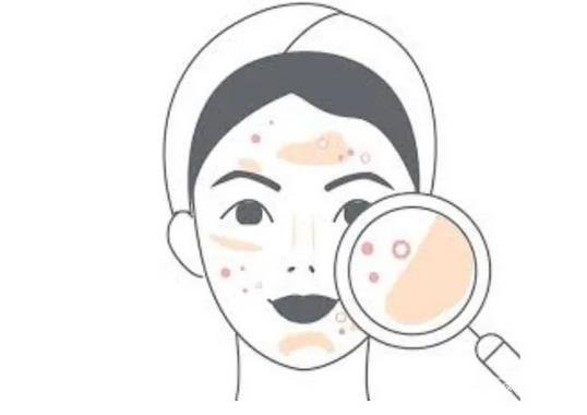 青醫(yī)附院整形科*新價(jià)格表公布,附點(diǎn)痣真人案例術(shù)后*果