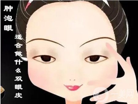 北京處靳小雷怎么預(yù)約？雙眼皮修復(fù)案例及整形價(jià)格表