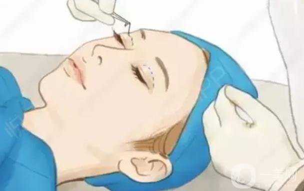 眼部整形的下眼下至術(shù)前準(zhǔn)備工作主要有哪些？