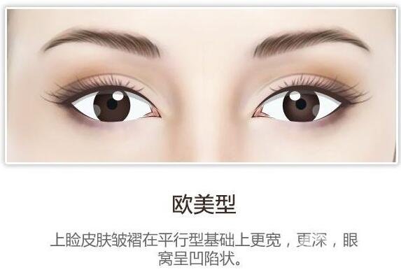 開眼角后疤痕增生怎么辦？