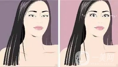 南醫(yī)大二附院割雙眼皮多少錢？整形價格表及術后*果圖一覽