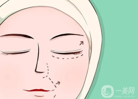 注射玻尿酸去除黑眼圈有用嗎 *果怎么樣