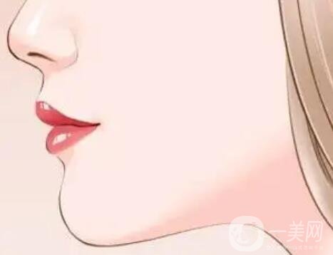 雙下巴抽脂多久恢復 雙下巴吸脂幾天恢復