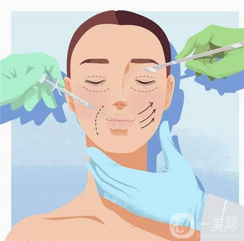 割雙眼皮,割雙眼皮*果