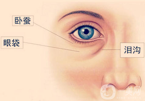 玻尿酸豐臥蠶會擴散嗎 注意事項有哪些