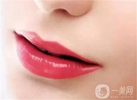 豐唇需要多少錢呢？