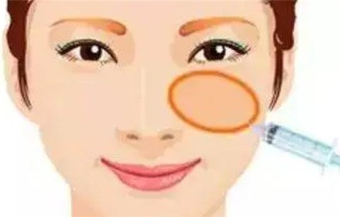 一針*能打兩邊嗎？