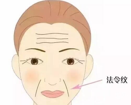 法令紋怎么去除呢？