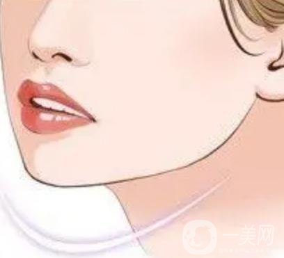 玻尿酸填充下巴有什么副作用嗎？