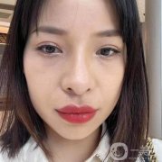 眼袋的形成讓我脾氣變得暴躁起來(lái)，父母說(shuō)我是因?yàn)橥ㄏ蛘呤菒?ài)哭才發(fā)生的