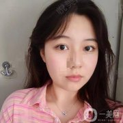 大家都說(shuō)臉上有疤的人，小時(shí)候一定會(huì)皮，我爸媽都管不住我