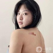 對(duì)于我們這種身上有疤的人來(lái)說(shuō)，每一塊地方都是一個(gè)特別痛苦的回憶