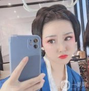 醫(yī)生給出了建議做面部吸脂的手術(shù)，感覺是不錯(cuò)的，態(tài)度很親切