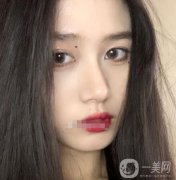 近聽我的朋友說，熱瑪吉特別的火，他是一個抗衰老的項目