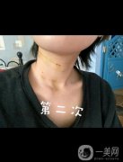 脖子真的就是女人的第二張臉，所以大家在保養(yǎng)自己臉蛋的同時，也不要忘記自
