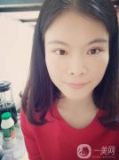 我覺得現(xiàn)在的眼睛還不如手術(shù)之前的單眼皮好看呢，正等我為自己更加難看的眼