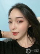 雖然熱瑪吉手術(shù)不是什么開(kāi)刀的大手術(shù)，但我還是很謹(jǐn)慎