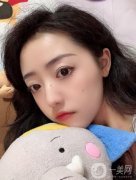 醫(yī)生也是建議本人做個(gè)拉皮的項(xiàng)目，看了許多案例，感覺(jué)做出來(lái)效果相當(dāng)不錯(cuò)