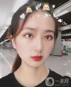 眼綜合手術(shù)已經(jīng)過去四個月的時間了，自從我做完手術(shù)之后，我?guī)ьI(lǐng)了我身邊的