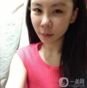 因?yàn)槲易约荷砩系闹静皇翘啵葬t(yī)生看到我這樣的面部直接給我推薦的是