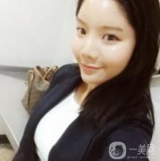 做完面部填充手術(shù)已經(jīng)過(guò)去一周的時(shí)間了，其實(shí)自己照鏡子就能發(fā)現(xiàn)這段時(shí)間恢