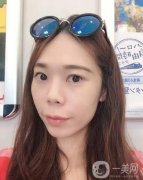 做完熱瑪吉項(xiàng)目已經(jīng)兩個(gè)月的時(shí)間了，近我還給醫(yī)生發(fā)去了我現(xiàn)在的照片