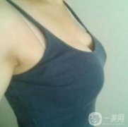 在隆胸拆線之后幾乎我就恢復(fù)了正常的生活了，也可以正常的洗澡了，就是需要