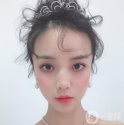 做完隆鼻手術(shù)已經(jīng)有一個月的時間了，身邊的朋友看到我都說我的鼻子變好看了